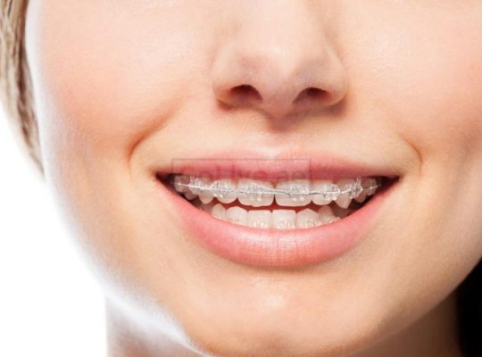 Orthodontist in Abu Dhabi
