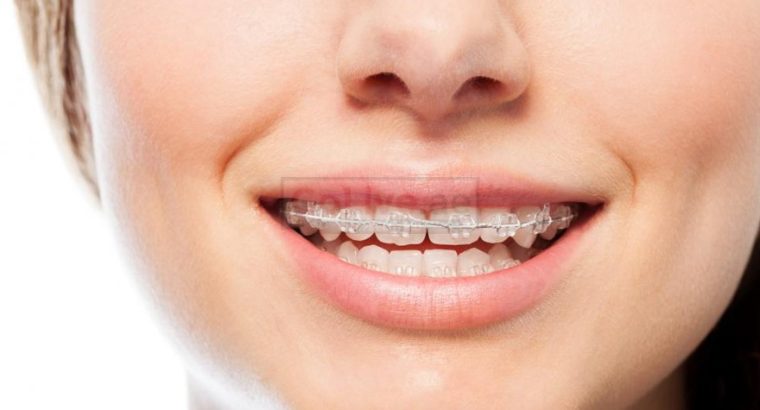Orthodontist in Abu Dhabi