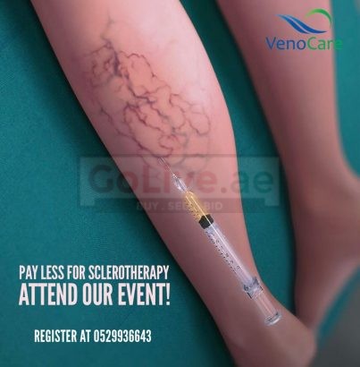 VenoCare – One Stop Clinic for Varicose Veins Treatment