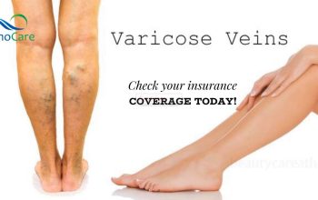 VenoCare – One Stop Clinic for Varicose Veins Treatment
