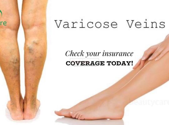 VenoCare – One Stop Clinic for Varicose Veins Treatment