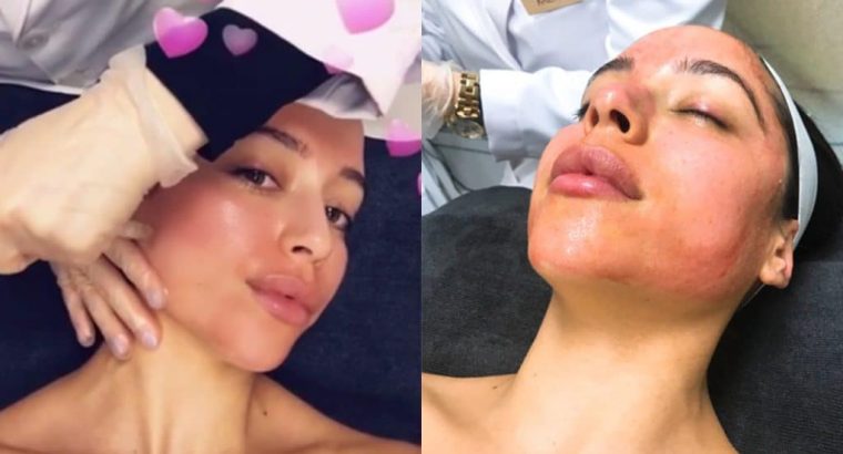 Hair PRP Facial Beauty treatment