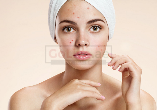 Professional Psoriasis Treatment in Ayurveda