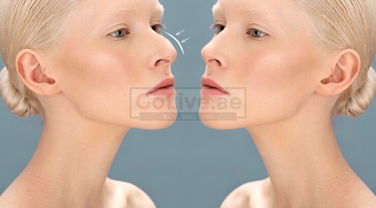 Best rhinoplasty surgeon in Dubai